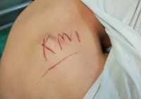 Zatrzymani za rozboje, pobicia i tortury - zdjęcie główne