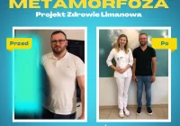 Imponująca metamorfoza Pana Jacka w Projekt Zdrowie! - zdjęcie główne