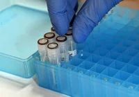 Raport: od 8 do 14 września 29 tys. zakażeń, zmarło 105 osób z COVID-19 - zdjęcie główne