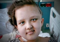 Guzy w głowie 11-letniej Julki - zdjęcie główne