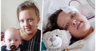 Guzy w głowie 11-letniej Julki - zdjęcie 2