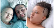Guzy w głowie 11-letniej Julki - zdjęcie 3