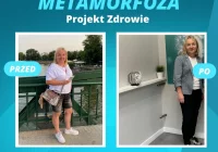 Kolejna metamorfoza w Projekt Zdrowie. Pani Edyta schudła 16 kilogramów! - zdjęcie główne