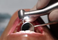 Dbanie o zęby może chronić stawy - zdjęcie główne