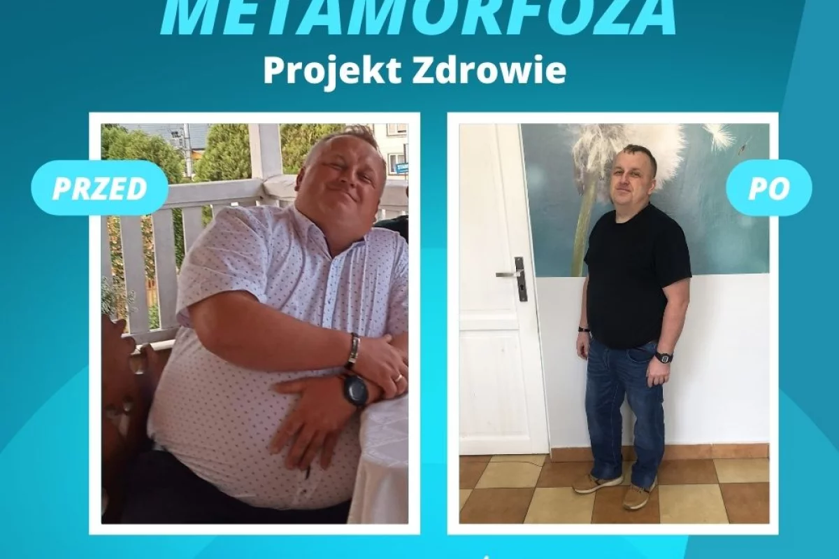 Spektakularna metamorfoza z Projekt Zdrowie! Pan Jarek – 37 kg w ciągu 7 miesięcy kuracji