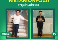 Maksymilian - wyjątkowy chłopiec – wyjątkowe 10 kg mniej! - zdjęcie główne