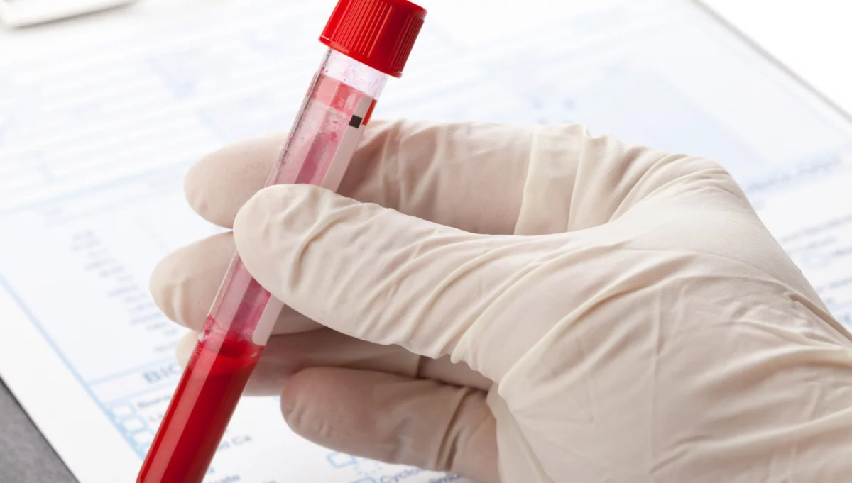 Kiedy wykonać badanie krwi i jak się do niego przygotować?