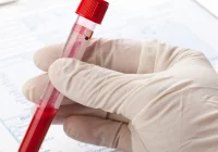 Kiedy wykonać badanie krwi i jak się do niego przygotować? - zdjęcie główne