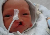 Potrzebna pomoc dla małego Gabrysia - zdjęcie główne