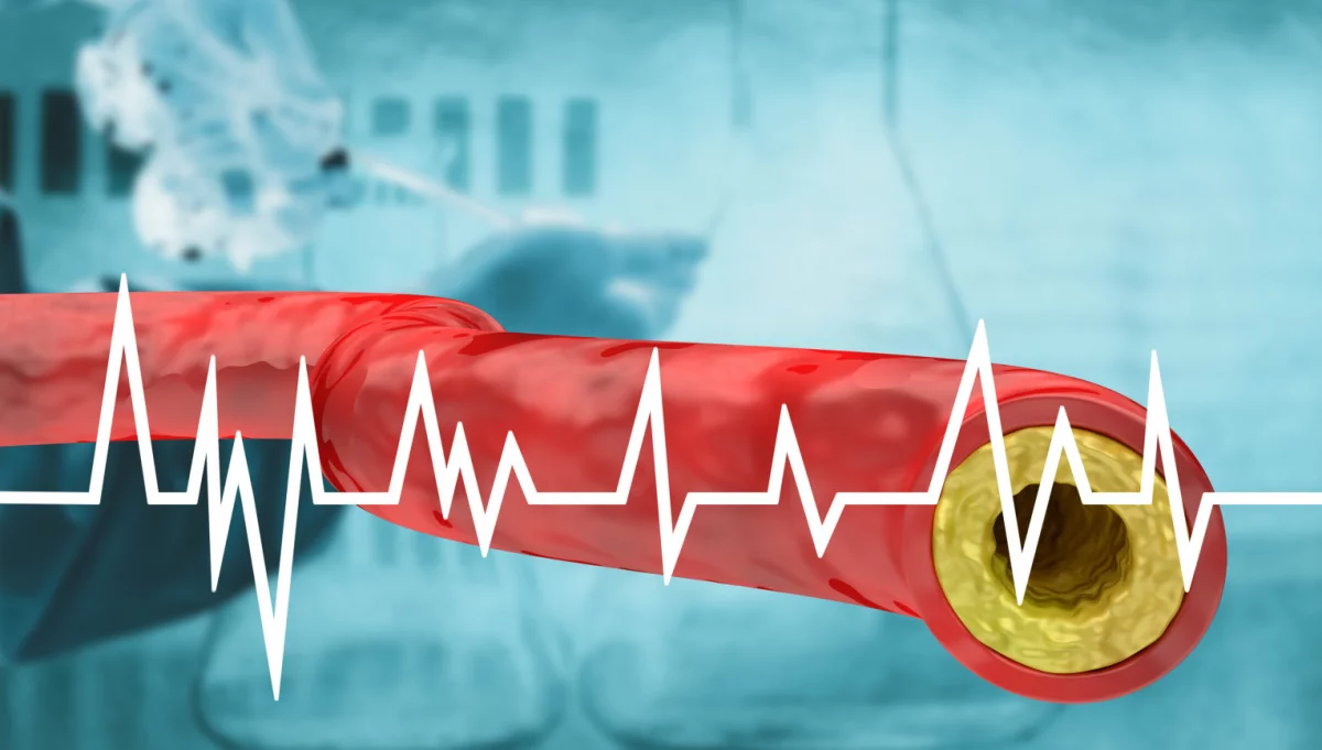 Dobry i zły cholesterol: Czy podział nadal jest właściwy?