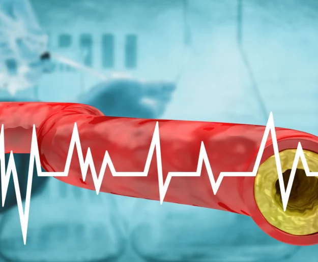 Rzadko badany parametr krwi mówi więcej, niż poziom cholesterolu - zdjęcie główne