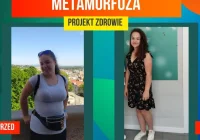 Metamorfoza w Centrum Dietetycznym Projekt Zdrowie. Pani Wioletta schudła 13 kg! - zdjęcie główne
