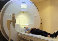 Specyficzne zmiany w mózgach po COVID-19 - zdjęcie główne