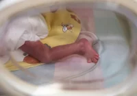 Zespół nagłej niewyjaśnionej śmierci dzieci (SIDS) - potencjalne przyczyny - zdjęcie główne