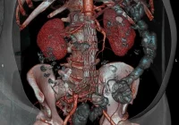 Nowy tomograf z własnych środków - zdjęcie główne