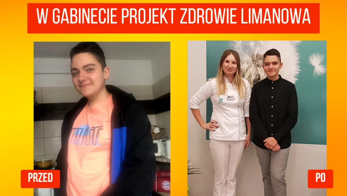 Metamorfoza w Projekt Zdrowie: Szymon i jego droga do utraty 16 kg