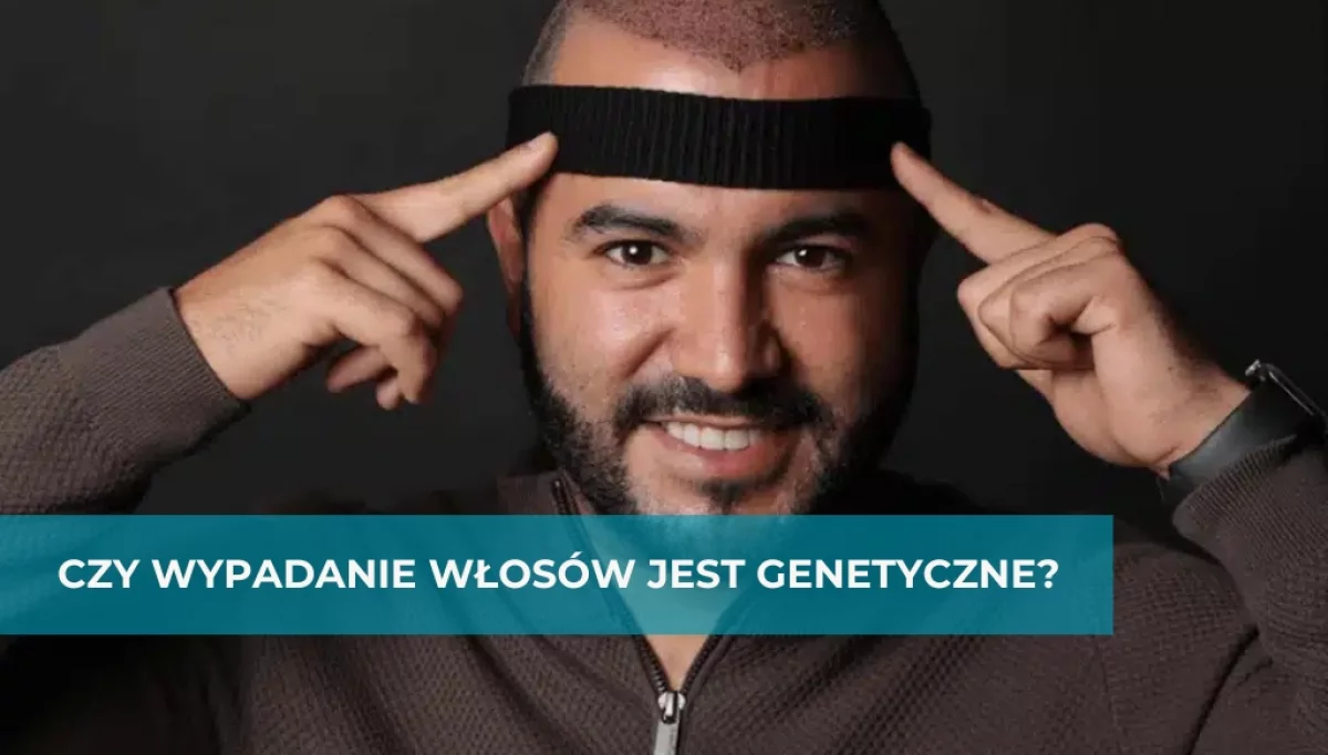 Czy wypadanie włosów jest genetyczne?