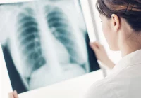 Bezpłatna spirometria i USG płuc - zapisy trwają - zdjęcie główne