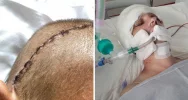 Przeżył cudem, teraz potrzebuje leczenia i rehabilitacji - zdjęcie 3