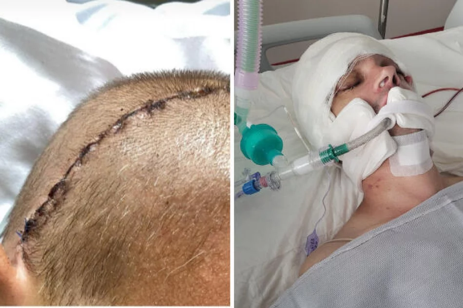 Przeżył cudem, teraz potrzebuje leczenia i rehabilitacji - zdjęcie 3