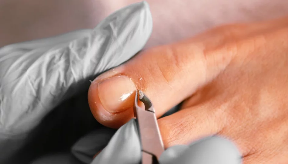 Preparat do usuwania skórek – jak przygotować paznokcie do manicure hybrydowego? - zdjęcie 1